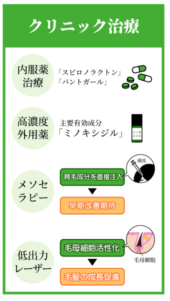 女性の薄毛治療方法