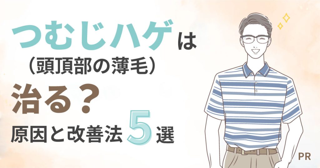 つむじハゲ（頭頂部の薄毛）は治る?原因と改善法5選