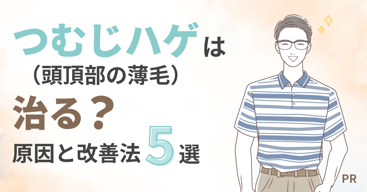 つむじハゲ（頭頂部の薄毛）は治る?原因と改善法5選