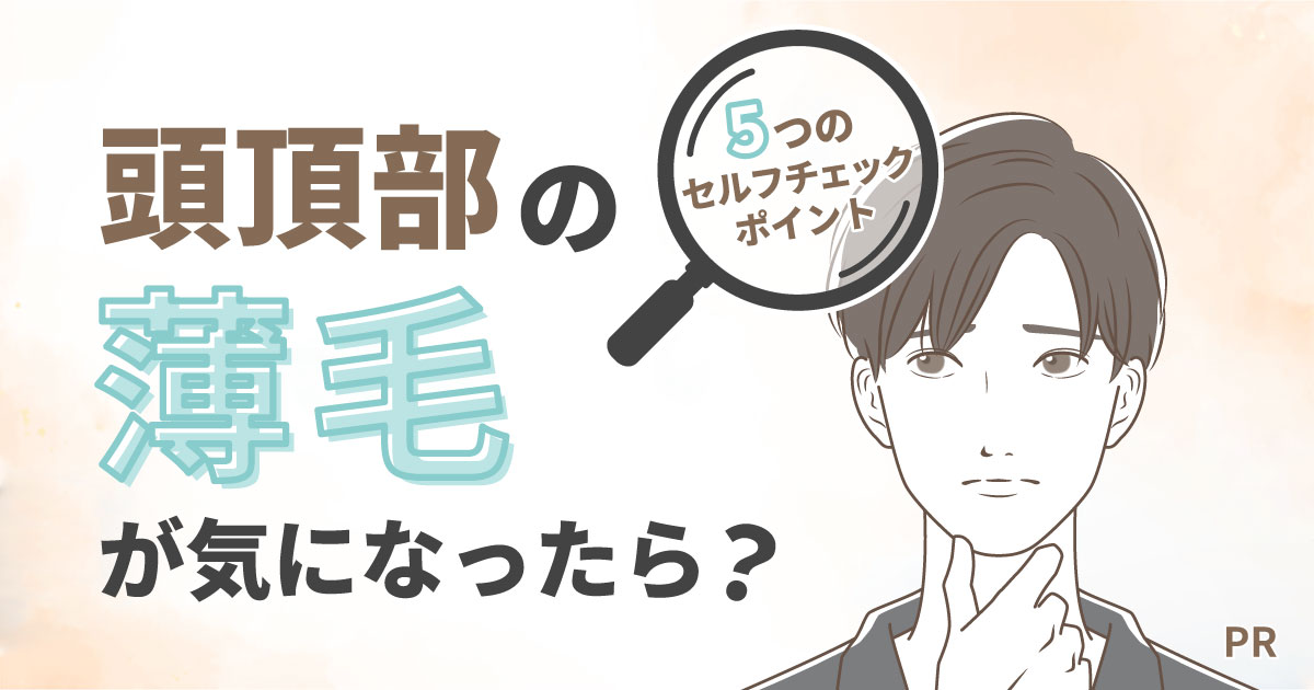 頭頂部の薄毛が気になったら？5つのセルフチェックポイント
