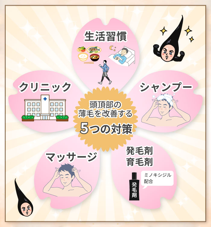 頭頂部の薄毛を改善する5つの対策方法