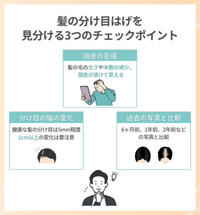 髪の分け目はげを見分ける3つのチェックポイント