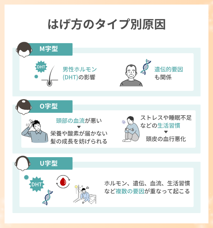 はげ方の種類はM字・O字・U字型！原因と対策方法を解説