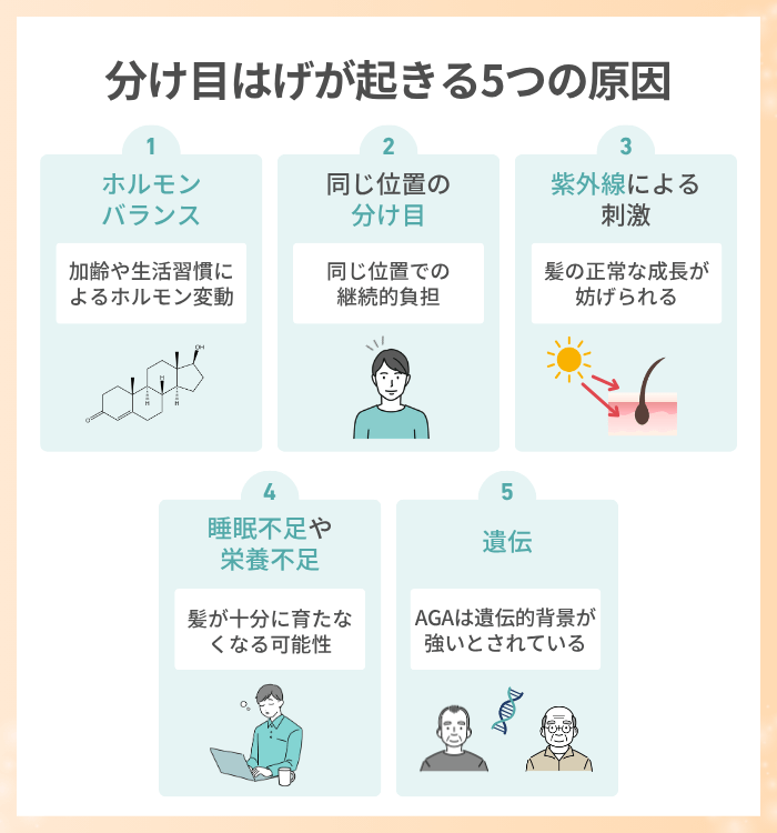 分け目はげが起きる５つの原因を解説