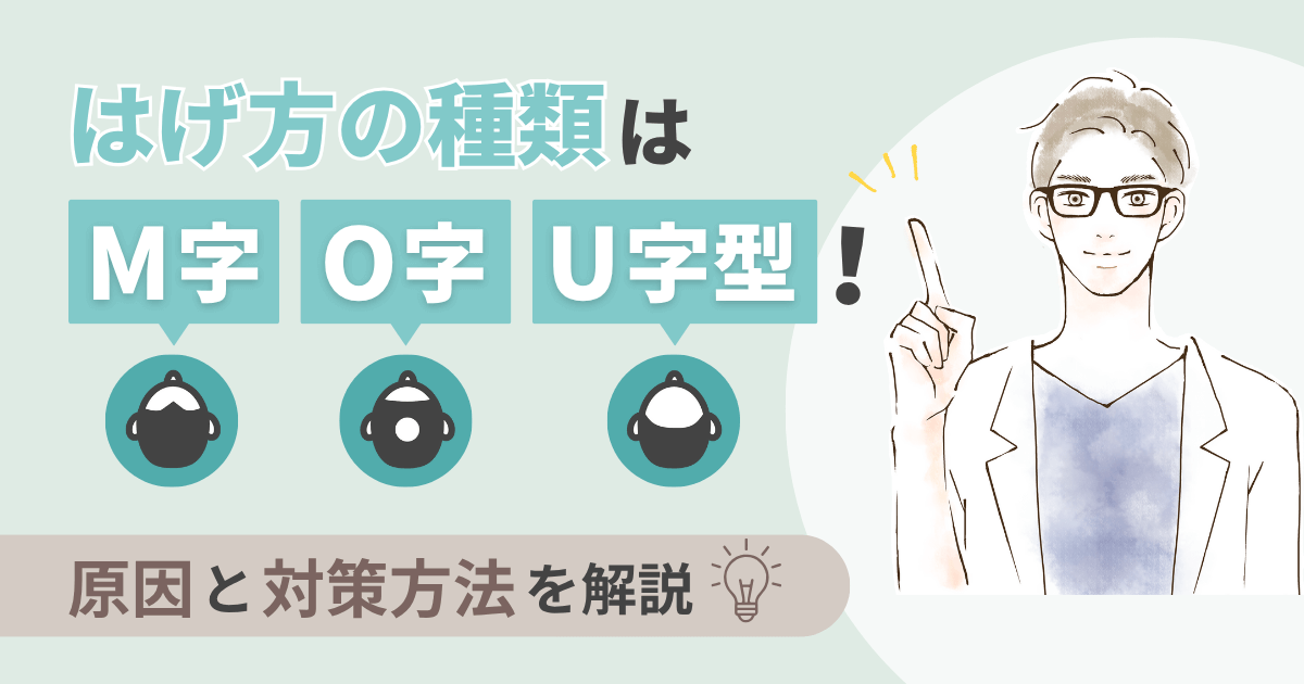 はげ方の種類はM字・O字・U字型！原因と対策方法を解説