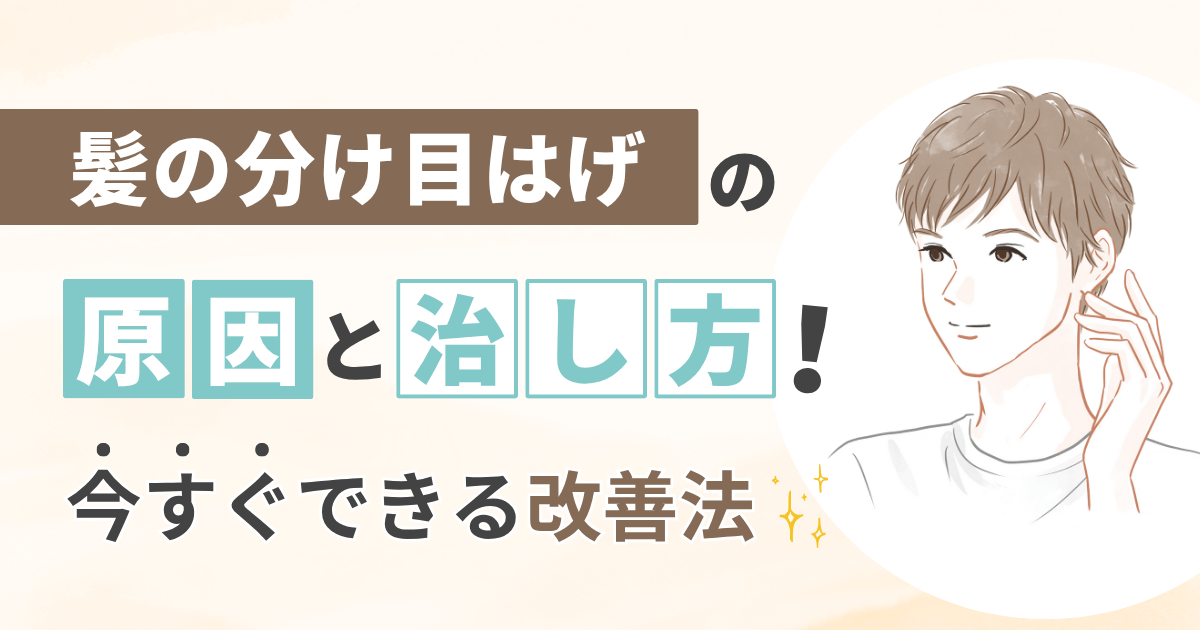 髪の分け目はげの原因と治し方！今すぐできる改善法