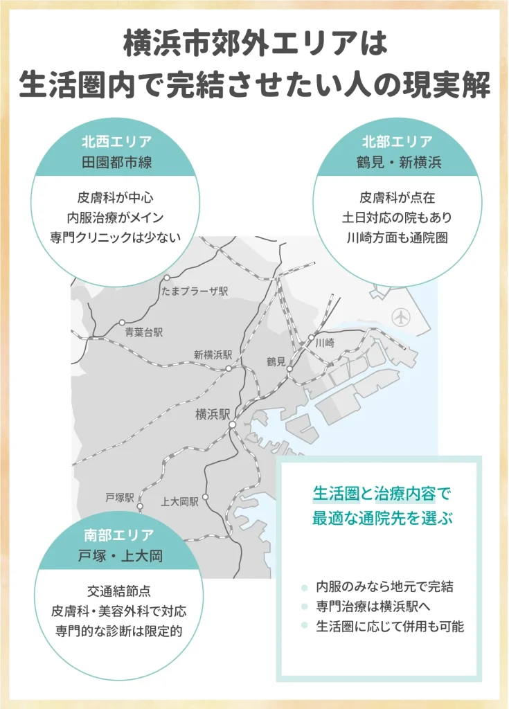 横浜市郊外と神奈川県内に住む方は自宅近くでAGA治療を続けられる