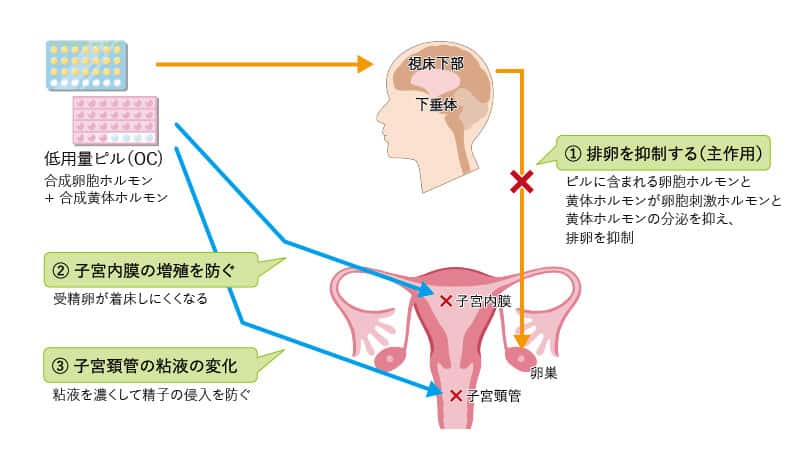 消退 アフター 出血 ない ピル